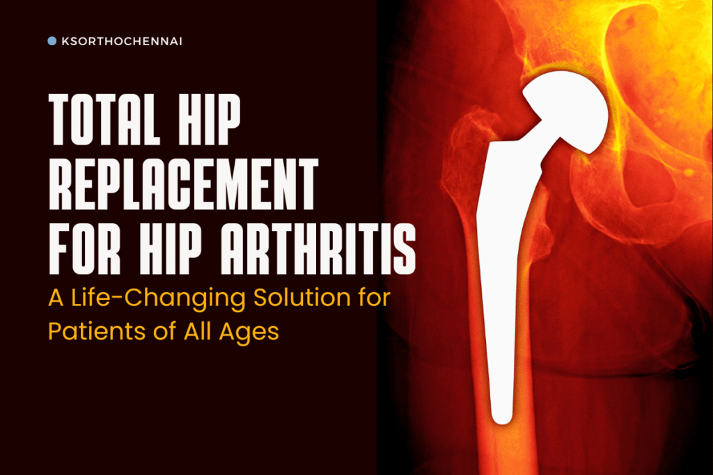 Total Hip Replacement Case Study