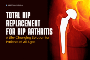 Total Hip Replacement Case Study