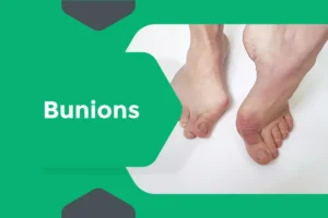 Orthopaedic foot specialist examining bunion deformity during consultation