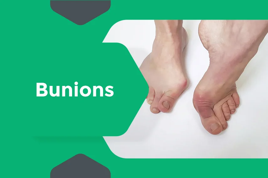 Orthopaedic foot specialist examining bunion deformity during consultation