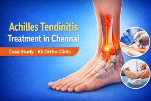 achilles tendinitis treatment in chennai madipakkam