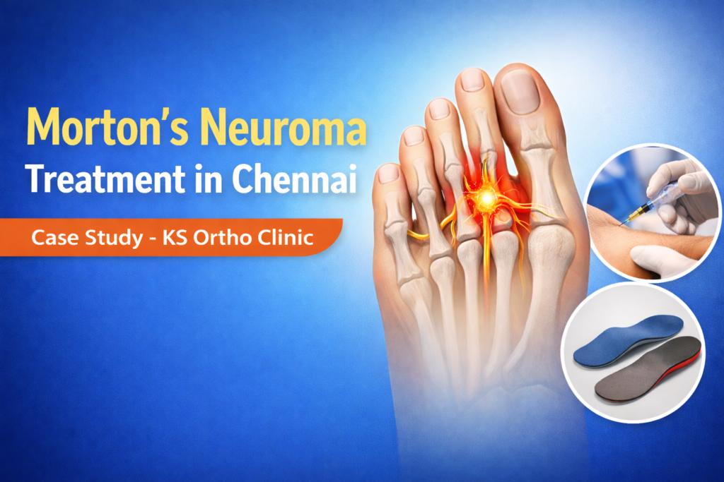 Case Study: Successful Morton’s Neuroma Treatment in Chennai
