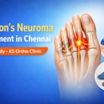 Case Study: Successful Morton’s Neuroma Treatment in Chennai