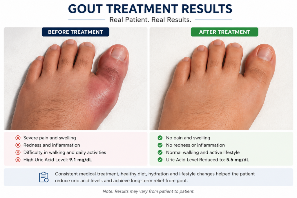 gout treatment in chennai madipakkam
