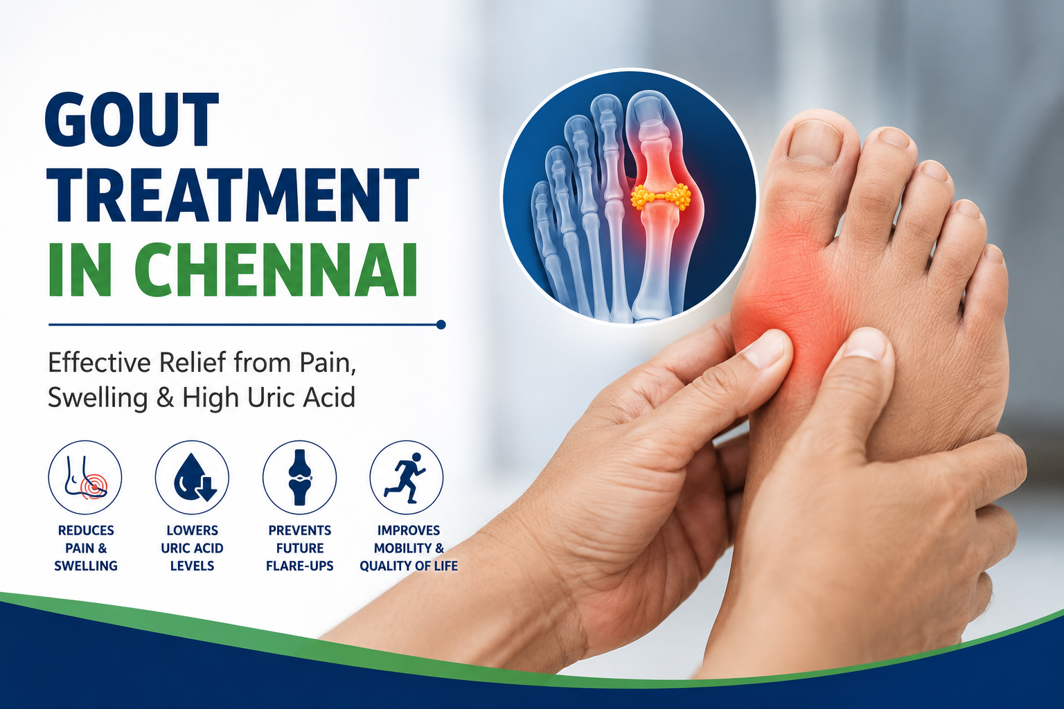 gout-treatment-results-featured gout treatment in chennai madipakkam