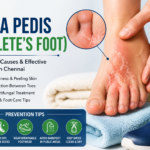 Tinea Pedis (Athlete’s Foot) Treatment in Chennai