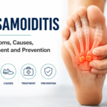 Sesamoiditis: Symptoms, Causes, Treatment and Prevention