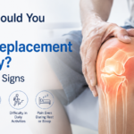 When Should You Consider Knee Replacement Surgery? 7 Warning Signs